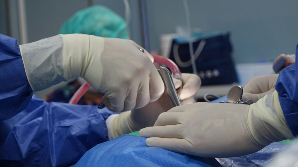 Ojo de persona mayor con una catarata visible, mostrando opacidad en el cristalino