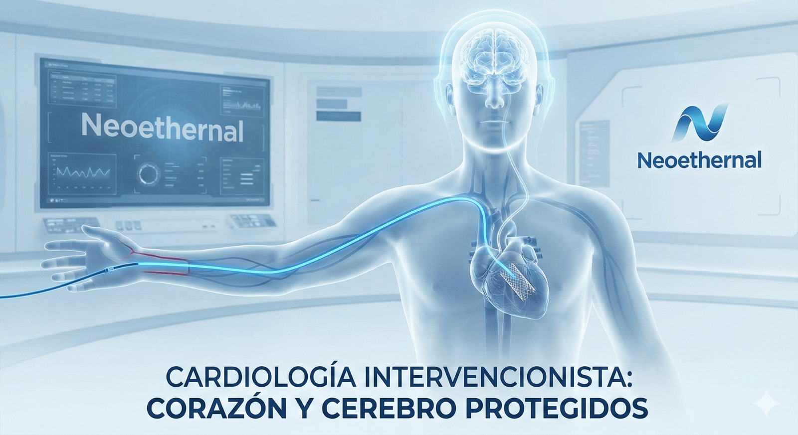 Visualización médica de un catéter navegando por las arterias hacia el corazón en un procedimiento de cardiología intervencionista